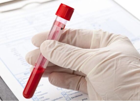 Os métodos de diagnóstico de laboratorio permiten identificar a microflora ou virus patolóxicos